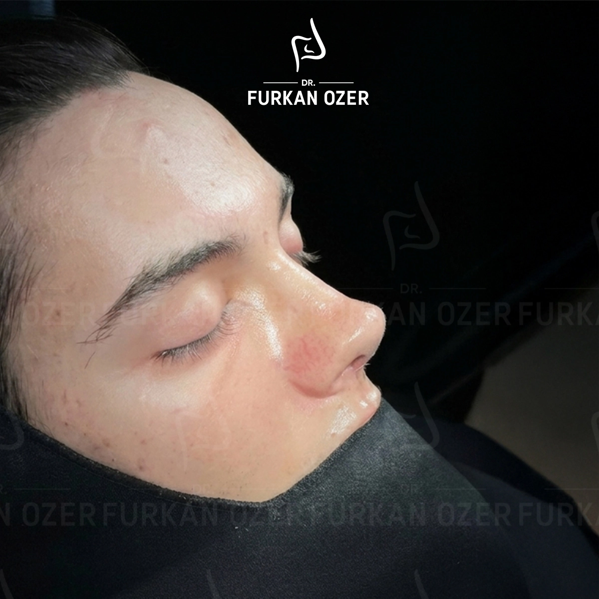 بعد 3