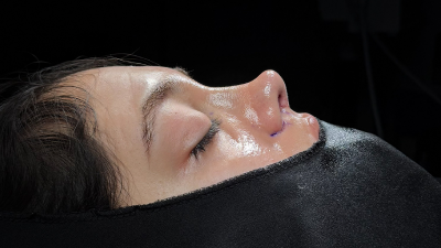 تجميل الحاجز الأنفي تركيا